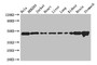 Western Blot; Positive WB detected in: Hela whole cell lysate, HEK293 whole cell lysate, Jurkat whole cell lysate, Mouse heart tissue, Mouse liver tissue, Mouse lung tissue, Mouse kidney tissue, Mouse brain tissue, Mouse stomach tissue; All lanes: ASCC1 antibody at 2.7µg/ml; Secondary; Goat polyclonal to rabbit IgG at 1/50000 dilution; Predicted band size: 46, 42 kDa; Observed band size: 46 kDa