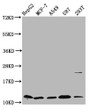 Western Blot; , Positive WB detected in: HepG2 whole cell lysate, MCF-7 whole cell lysate, A549 whole cell lysate, U87 whole cell lysate, 293T whole cell lysate; , All lanes: CSTB antibody at 5.36µg/ml; , Secondary; , Goat polyclonal to rabbit IgG at 1/50000 dilution; , Predicted band size: 12 kDa; , Observed band size: 12 kDa