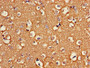 Immunohistochemistry of paraffin-embedded human brain tissue using CAC08253 at dilution of 1:100