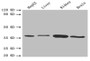 Western blot; All lanes: BDH1 antibody at 2.4µg/ml; Lane 1: HepG2 whole cell lysate; Lane 2: Mouse liver tissue; Lane 3: Mouse kidney tissue; Lane 4: Mouse brain tissue; Secondary; Goat polyclonal to rabbit IgG at 1/10000 dilution; Predicted band size: 39 kDa; Observed band size: 39 kDa
