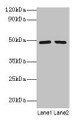Western blot; All lanes: DDX39B antibody at 2µg/ml; Lane 1: EC109 whole cell lysate; Lane 2: 293T whole cell lysate; Secondary; Goat polyclonal to rabbit IgG at 1/15000 dilution; Predicted band size: 49, 51 kDa; Observed band size: 49 kDa