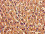 Immunohistochemistry of paraffin-embedded human liver tissue using CAC08273 at dilution of 1:100