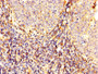 IHC image diluted at 1:300 and staining in paraffin-embedded human tonsil tissue performed on a Leica BondTM system. After dewaxing and hydration, antigen retrieval was mediated by high pressure in a citrate buffer (pH 6.0). Section was blocked with 10% normal goat serum 30min at RT. Then primary antibody (1% BSA) was incubated at 4°C overnight. The primary is detected by a biotinylated secondary antibody and visualized using an HRP conjugated SP system.