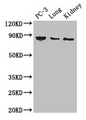 Western Blot; Positive WB detected in: PC-3 whole cell lysate, Mouse lung tissue, Mouse kidney tissue; All lanes: CARS antibody at 3µg/ml; Secondary; Goat polyclonal to rabbit IgG at 1/50000 dilution; Predicted band size: 86, 83, 95 kDa; Observed band size: 86 kDa