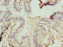 Immunohistochemistry of paraffin-embedded human lung tissue using CAC08284 at dilution of 1:100