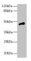 Western blot; All lanes: CASQ1 antibody at 5µg/ml + Mouse brain tissue; Secondary; Goat polyclonal to rabbit IgG at 1/10000 dilution; Predicted band size: 46 kDa; Observed band size: 46 kDa