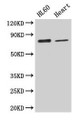 Western Blot; Positive WB detected in: HL60 whole cell lysate, Mouse heart tissue; All lanes: CAST antibody at 2.6µg/ml; Secondary; Goat polyclonal to rabbit IgG at 1/50000 dilution; Predicted band size: 77, 76, 64, 72, 82, 85, 83, 75, 81 kDa; Observed band size: 77 kDa