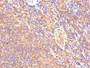 IHC image diluted at 1:500 and staining in paraffin-embedded human lymph node tissue performed on a Leica BondTM system. After dewaxing and hydration, antigen retrieval was mediated by high pressure in a citrate buffer (pH 6.0). Section was blocked with 10% normal goat serum 30min at RT. Then primary antibody (1% BSA) was incubated at 4°C overnight. The primary is detected by a biotinylated secondary antibody and visualized using an HRP conjugated SP system.