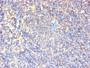 Immunohistochemistry of paraffin-embedded human lymphoid tissue using CAC08296 at dilution of 1:100