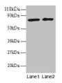 Western blot; All lanes: BLOC1S1 antibody at 2µg/ml; Lane 1: EC109 whole cell lysate; Lane 2: 293T whole cell lysate; Secondary; Goat polyclonal to rabbit IgG at 1/15000 dilution; Predicted band size: 18, 15 kDa; Observed band size: 75 kDa