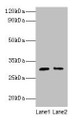 Western blot; All lanes: Cd82 antibody at 2µg/ml; Lane 1: Jurkat whole cell lysate; Lane 2: A549 whole cell lysate; Secondary; Goat polyclonal to rabbit IgG at 1/10000 dilution; Predicted band size: 30 kDa; Observed band size: 30 kDa