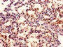 Immunohistochemistry of paraffin-embedded human lung tissue using CAC08300 at dilution of 1:100