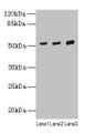 Western blot; ,All lanes: CDR2 antibody at 4µg/ml; ,Lane 1: Mouse lung tissue; ,Lane 2: Hela whole cell lysate; ,Lane 3: HepG2 whole cell lysate; ,Secondary; ,Goat polyclonal to rabbit IgG at 1/10000 dilution; ,Predicted band size: 52 kDa; ,Observed band size: 52 kDa