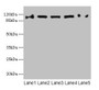 Western blot; All lanes: COPB1 antibody at 1µg/ml; Lane 1: Hela whole cell lysate; Lane 2: Jurkat whole cell lysate; Lane 3: NIH/3T3 whole cell lysate; Lane 4: Mouse liver tissue; Lane 5: A549 whole cell lysate; Secondary; Goat polyclonal to rabbit IgG at 1/10000 dilution; Predicted band size: 108 kDa; Observed band size: 108 kDa