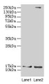 Western blot; All lanes: CRABP1 antibody at 4µg/ml; Lane 1: Mouse eye tissue; Lane 2: THP-1 whole cell lysate; Secondary; Goat polyclonal to rabbit IgG at 1/10000 dilution; Predicted band size: 16 kDa; Observed band size: 16 kDa