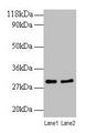 Western blot; All lanes: RPL8 antibody at 2µg/ml; Lane 1: EC109 whole cell lysate; Lane 2: 293T whole cell lysate; Secondary; Goat polyclonal to rabbit IgG at 1/10000 dilution; Predicted band size: 29 kDa; Observed band size: 29 kDa
