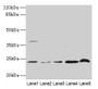 Western blot; ,All lanes: CRYBA1 antibody at 6µg/ml; ,Lane 1: Human placenta tissue; ,Lane 2: U251 whole cell lysate; ,Lane 3: U937 whole cell lysate; ,Lane 4: Mouse stomach tissue; ,Lane 5: Mouse liver tissue; ,Secondary; ,Goat polyclonal to rabbit IgG at 1/10000 dilution; ,Predicted band size: 26, 24 kDa; ,Observed band size: 24 kDa