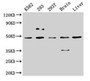 Western Blot; Positive WB detected in: K562 whole cell lysate, 293 whole cell lysate, 293T whole cell lysate, Rat brain tissue, Mouse liver tissue; All lanes: CSNK1D antibody at 5µg/ml; Secondary; Goat polyclonal to rabbit IgG at 1/50000 dilution; Predicted band size: 48, 47 kDa; Observed band size: 48 kDa