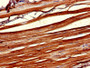 IHC image diluted at 1:1000 and staining in paraffin-embedded human skeletal muscle tissue performed on a Leica BondTM system. After dewaxing and hydration, antigen retrieval was mediated by high pressure in a citrate buffer (pH 6.0). Section was blocked with 10% normal goat serum 30min at RT. Then primary antibody (1% BSA) was incubated at 4°C overnight. The primary is detected by a biotinylated secondary antibody and visualized using an HRP conjugated SP system.
