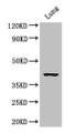 Western Blot; Positive WB detected in: Mouse lung tissue; All lanes: CYSLTR1 antibody at 3µg/ml; Secondary; Goat polyclonal to rabbit IgG at 1/50000 dilution; Predicted band size: 39 kDa; Observed band size: 39 kDa;