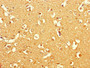 Immunohistochemistry of paraffin-embedded human brain tissue using CAC08353 at dilution of 1:100
