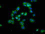 Immunofluorescence staining of HepG2 cells with CAC08362 at 1:100, counter-stained with DAPI. The cells were fixed in 4% formaldehyde, permeabilized using 0.2% Triton X-100 and blocked in 10% normal Goat Serum. The cells were then incubated with the antibody overnight at 4°C. The secondary antibody was Alexa Fluor 488-congugated AffiniPure Goat Anti-Rabbit IgG(H+L).