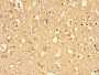 Immunohistochemistry of paraffin-embedded human brain tissue using CAC08369 at dilution of 1:100