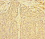 Immunohistochemistry of paraffin-embedded human ovarian cancer using CAC08373 at dilution of 1:100