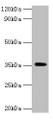 Western blot; ,All lanes: DOK5 antibody at 2µg/ml + Mouse kidney tissue; ,Secondary; ,Goat polyclonal to rabbit IgG at 1/15000 dilution; ,Predicted band size: 36, 23 kDa; ,Observed band size: 36 kDa