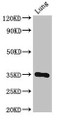 Western Blot; Positive WB detected in: Mouse lung tissue; All lanes: DPM1 antibody at 3µg/ml; Secondary; Goat polyclonal to rabbit IgG at 1/50000 dilution; Predicted band size: 30 kDa; Observed band size: 30 kDa;
