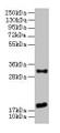 Western Blot; ,All lanes: EMP3 antibody at 3µg/ml + Mouse heart tissue; ,Secondary; ,Goat polyclonal to rabbit IgG at 1/10000 dilution; ,Predicted band size: 19 kDa; ,Observed band size: 19, 31 kDa