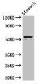 Western Blot; Positive WB detected in: Mouse stomach tissue; All lanes: ENTPD8 antibody at 2µg/ml; Secondary; Goat polyclonal to rabbit IgG at 1/50000 dilution; Predicted band size: 54, 50 kDa; Observed band size: 54 kDa