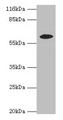 Western blot; All lanes: EPHX2 antibody at 2µg/ml + MCF-7 whole cell lysate; Secondary; Goat polyclonal to rabbit IgG at 1/10000 dilution; Predicted band size: 63, 58, 56 kDa; Observed band size: 58 kDa