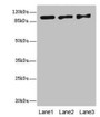 Western blot; All lanes: EXO1 antibody at 10µg/ml; Lane 1: Hela whole cell lysate; Lane 2: 293T whole cell lysate; Lane 3: A549 whole cell lysate; Secondary; Goat polyclonal to rabbit IgG at 1/10000 dilution; Predicted band size: 95, 90 kDa; Observed band size: 95 kDa;