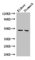 Western Blot; Positive WB detected in: Mouse kidney tissue, Mouse stomach tissue; All lanes: FAH antibody at 3.4µg/ml; Secondary; Goat polyclonal to rabbit IgG at 1/50000 dilution; Predicted band size: 47, 39 kDa; Observed band size: 47 kDa