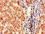 Immunohistochemistry of paraffin-embedded human liver tissue using CAC08422 at dilution of 1:100