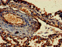 Immunohistochemistry of paraffin-embedded human lung tissue using CAC08430 at dilution of 1:100