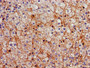 Immunohistochemistry of paraffin-embedded human adrenal gland tissue using CAC08433 at dilution of 1:100