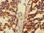 Immunohistochemistry of paraffin-embedded human lung tissue using CAC08435 at dilution of 1:100