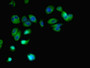 Immunofluorescent analysis of MCF-7 cells using CAC08435 at dilution of 1:100 and Alexa Fluor 488-congugated AffiniPure Goat Anti-Rabbit IgG(H+L)