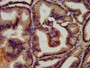 IHC image of CAC08442 diluted at 1:450 and staining in paraffin-embedded human prostate tissue performed on a Leica BondTM system. After dewaxing and hydration, antigen retrieval was mediated by high pressure in a citrate buffer (pH 6.0). Section was blocked with 10% normal goat serum 30min at RT. Then primary antibody (1% BSA) was incubated at 4°C overnight. The primary is detected by a biotinylated secondary antibody and visualized using an HRP conjugated SP system.