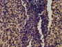 IHC image diluted at 1:450 and staining in paraffin-embedded human spleen tissue performed on a Leica BondTM system. After dewaxing and hydration, antigen retrieval was mediated by high pressure in a citrate buffer (pH 6.0). Section was blocked with 10% normal goat serum 30min at RT. Then primary antibody (1% BSA) was incubated at 4°C overnight. The primary is detected by a biotinylated secondary antibody and visualized using an HRP conjugated SP system.