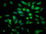 Immunofluorescence staining of Hela cells with CAC08442 at 1:150, counter-stained with DAPI. The cells were fixed in 4% formaldehyde, permeabilized using 0.2% Triton X-100 and blocked in 10% normal Goat Serum. The cells were then incubated with the antibody overnight at 4°C. The secondary antibody was Alexa Fluor 488-congugated AffiniPure Goat Anti-Rabbit IgG(H+L).