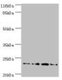 Western blot; All lanes: Fxn antibody at 2µg/ml; Lane 1: HepG2 whole cell lysate; Lane 2: Hela whole cell lysate; Lane 3: Mouse brain tissue; Lane 4: Jurkat whole cell lysate; Secondary; Goat polyclonal to rabbit IgG at 1/10000 dilution; Predicted band size: 23 kDa; Observed band size: 23 kDa