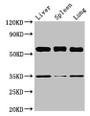 Western Blot; Positive WB detected in: Mouse liver tissue, Mouse spleen tissue, Mouse lung tissue; All lanes: Gba antibody at 3.5µg/ml; Secondary; Goat polyclonal to rabbit IgG at 1/50000 dilution; Predicted band size: 58 kDa; Observed band size: 58 kDa