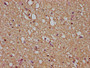 IHC image diluted at 1:200 and staining in paraffin-embedded human brain tissue performed on a Leica BondTM system. After dewaxing and hydration, antigen retrieval was mediated by high pressure in a citrate buffer (pH 6.0). Section was blocked with 10% normal goat serum 30min at RT. Then primary antibody (1% BSA) was incubated at 4°C overnight. The primary is detected by a biotinylated secondary antibody and visualized using an HRP conjugated SP system.