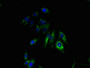 Immunofluorescent analysis of Hela cells using CAC08470 at dilution of 1:100 and Alexa Fluor 488-congugated AffiniPure Goat Anti-Rabbit IgG(H+L)