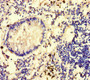 Immunohistochemistry of paraffin-embedded human appendix tissue using CAC08477 at dilution of 1:100