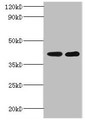 Western blot; All lanes: GLT8D2 antibody at 2µg/ml; Lane 1: Mouse heart tissue; Lane 2: Mouse kidney tissue; Secondary; Goat polyclonal to rabbit IgG at 1/10000 dilution; Predicted band size: 41 kDa; Observed band size: 41 kDa