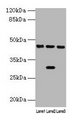 Western blot; All lanes: HPD antibody at 4.5µg/ml; Lane 1: Mouse kidney tissue; Lane 2: Mouse liver tissue; Lane 3: HepG2 whole cell lysate; Secondary; Goat polyclonal to rabbit IgG at 1/10000 dilution; Predicted band size: 45, 41 kDa; Observed band size: 45 kDa